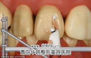 超聲波洗牙與牙膏的功效對(duì)比分析