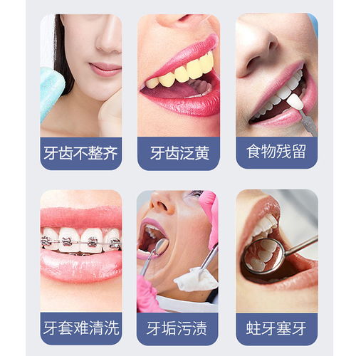 博皓便攜式智能洗牙器 開(kāi)啟高效、便捷的口腔清潔新體驗(yàn)